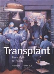 Transplant: From Myth to Reality