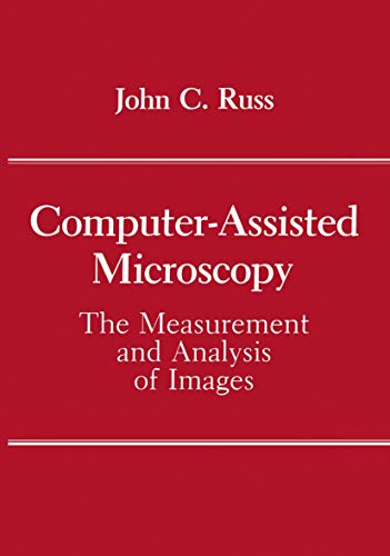 Computer Assisted Microscopy: The Measurement and Analysis of Images