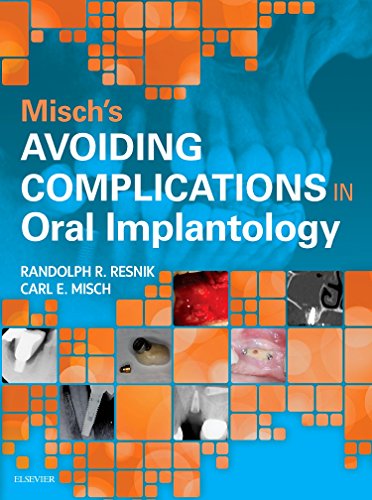 Misch - Avoiding Complications in Oral Implantology - 1E