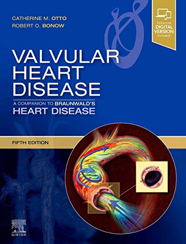 Valvular Heart Disease: A Companion to Braunwald's Heart Disease: Expert Consult - Online and Print
Valvular Heart Disease: A Companion to Braunwald's Heart Disease: Expert Consult - Online and Print