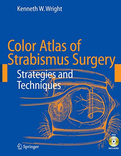 Color Atlas of Strabismus Surgery : Strategies and Techniques