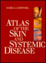 Atlas of the Skin and Systemic Disease, 1e