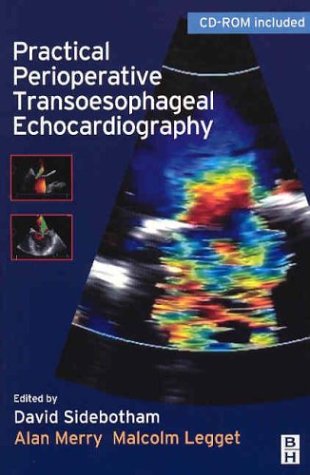 Practical Perioperative Transoesophageal Echocardiography: Text with CD-ROM