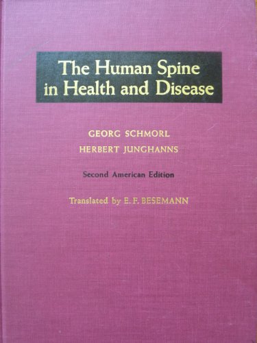The Human Spine in Health and Disease
