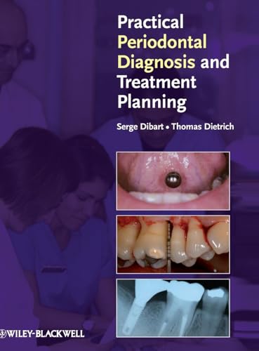 Practical Periodontal Diagnosis and Treatment Planning
