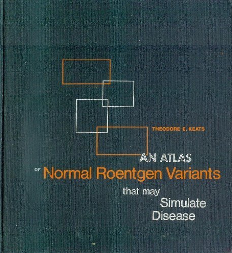An atlas of normal roentgen variants that may simulate disease