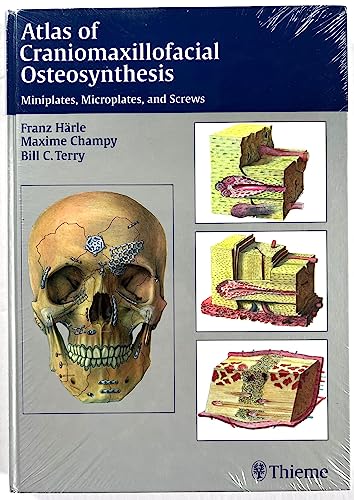 Atlas of Craniomaxillofacial Osteosynthesis: Microplates, Miniplates, and Screws Haerle, Franz; Champy, Maxime and Terry, Bill
Atlas of Craniomaxillofacial Osteosynthesis: Microplates, Miniplates, and Screws Haerle, Franz; Champy, Maxime and Terry, Bill