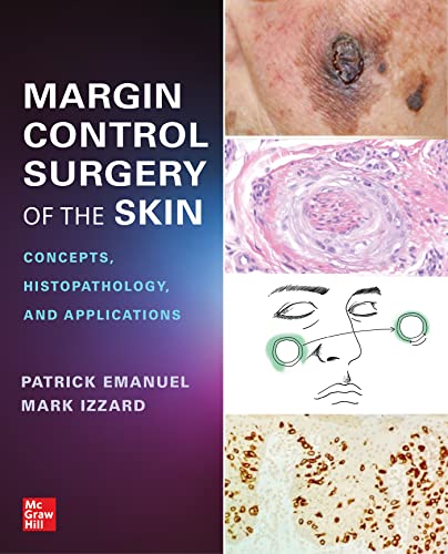 Margin Control Surgery of the Skin : Concepts, Histopathology, and Applications