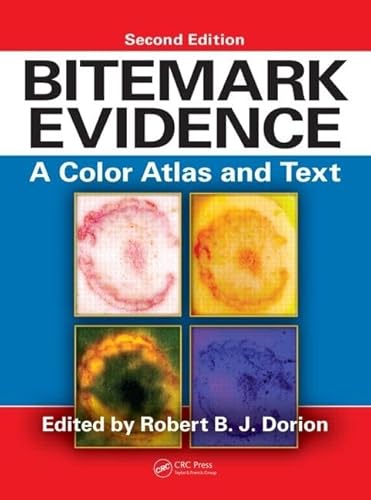 Bitemark Evidence A Color Atlas And Text 2Ed (Hb 2011)