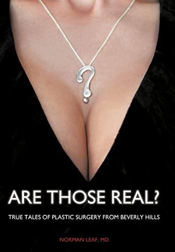 Are Those Real?: True Tales of Plastic Surgery from Beverly Hills