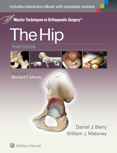 Master Techniques in Orthopaedic Surgery: The Hip