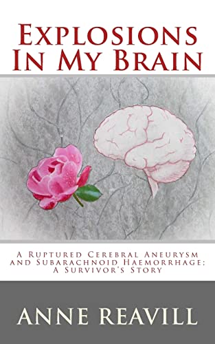 Explosions In My Brain: A ruptures cerebral aneurysm and subarachnoid haemorrhage; a surviver's story
Explosions In My Brain: A ruptures cerebral aneurysm and subarachnoid haemorrhage; a surviver's story