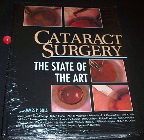 Cataract Surgery: The State of the Art