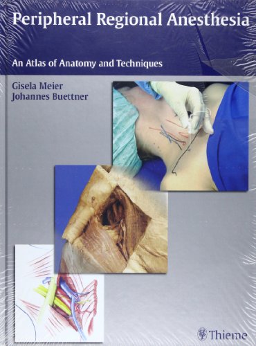 Peripheral Regional Anesthesia An Atlas of Anatomy & Techniques