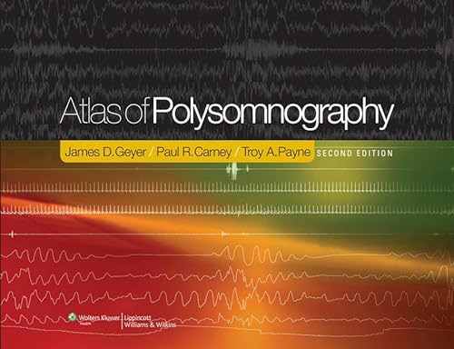 Atlas Of Polysomnography, 2E (Hb)