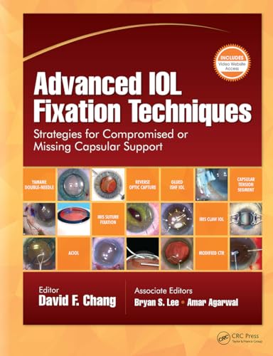 Advanced Iol Fixation Techniques : Strategies for Compromised or Missing Capsular Support
Advanced Iol Fixation Techniques : Strategies for Compromised or Missing Capsular Support