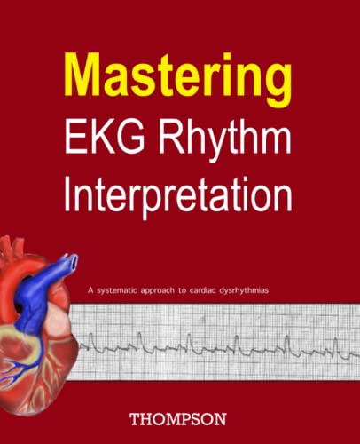 Mastering EKG Rhythm Interpretation: A systematic approach to cardiac dysrhythmias
Mastering EKG Rhythm Interpretation: A systematic approach to cardiac dysrhythmias