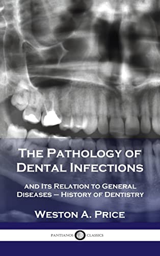 Pathology of Dental Infections: and Its Relation to General Diseases - History of Dentistry
Pathology of Dental Infections: and Its Relation to General Diseases - History of Dentistry
