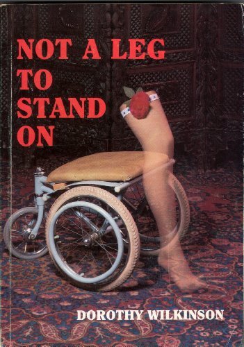 NOT A LEG TO STAND ON