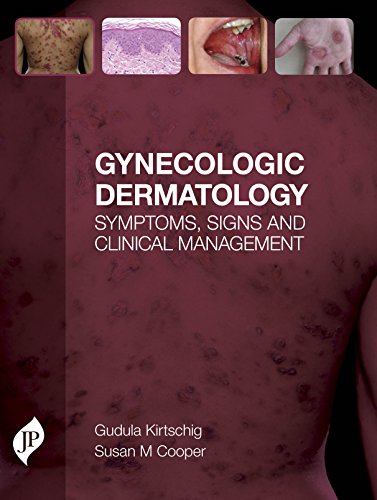 Gynecologic Dermatology Symptoms, Signs and Clinical Management