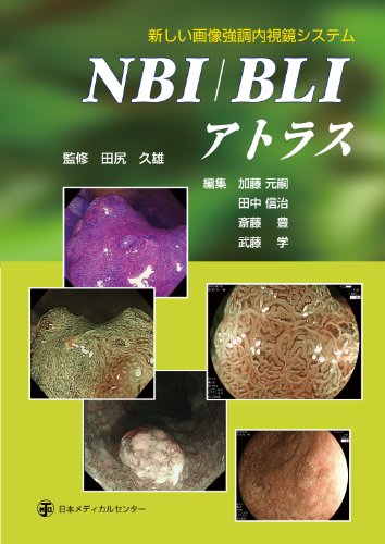 New image enhancement endoscope system NBI / BLI Atlas