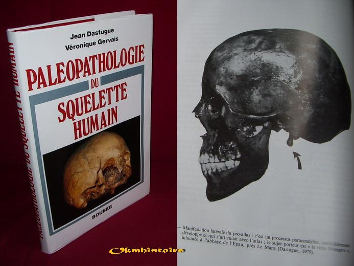 Paléopathologie du squelette humain - DASTUGUE ( Jean ) & GERVAIS ( Véronique )