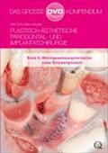 Plastisch-Ästhetische Parodontal- und Implantatchirurgie : Band 8: Weichgewebsaugmentation unter Brückengliedern - Otto Zuhr