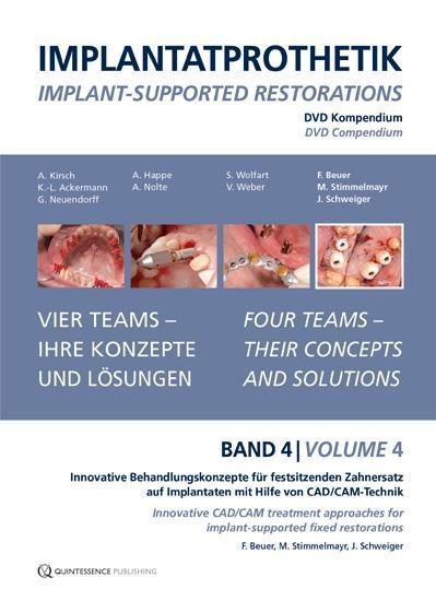 DVD-Kompendium Implantatprothetik 4 - Florian Beuer