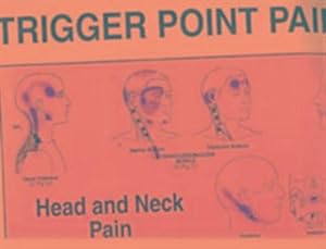 Travell And Simons Trigger Point Chart