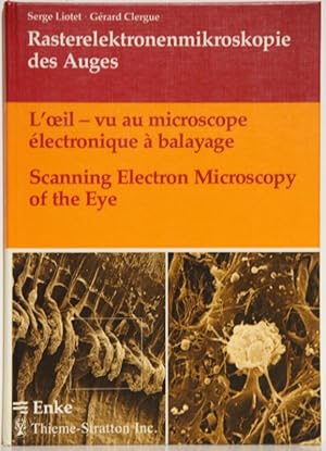 L'oeil - vu au microscope electronique a balayage / Rasterelektronenmikroskopie des Auges / Scann...