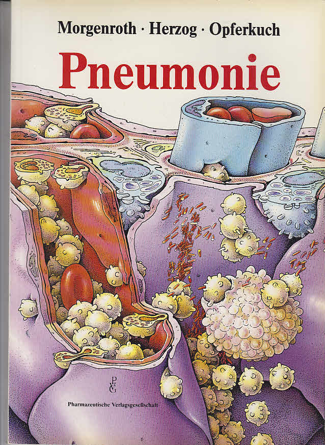 Pneumonie