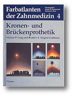 Farbatlanten der Zahnmedizin, Bd.4, Kronenprothetik und Brückenprothetik