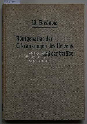 Röntgenatlas der Erkrankungen des Herzens und der Gefäße. Ein Leitfaden für Ärzte. Mit 87 Abbildu...