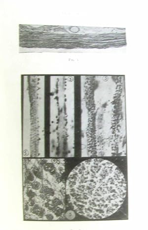 Le problème histochimique et histophysiologique du glycogène musculaire - le faits et les hypothèses