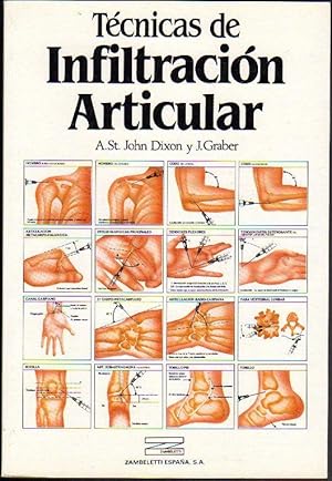 Técnicas de Infiltración Articular