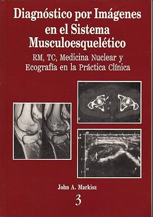 Diagnóstico por imágenes en el sistema musculoesquelético. RM, TC, Medicina Nuclear y Ecografía e...