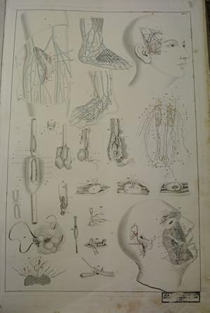 Bildtafel V: Zum Aderlassen, zur Arteriotomie, Unterbindung und Torsion der Gefässe und Durchschn...