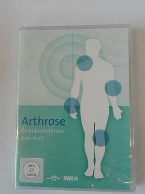 Arthrose: Genkschmerzen - Was nun?