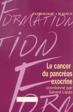 Le cancer du pancréas exocrine