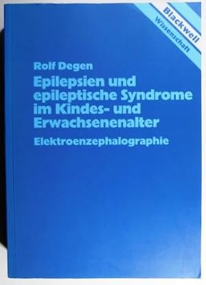 Epilepsien und epileptische Syndrome im Kindes- und Erwachsenenalter. Elektroenzephalographie.