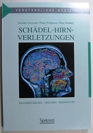 Schädel-Hirn-Verletzungen. Kranheistbilder-Ursachen-Behandlung. Verständliche Medizin.