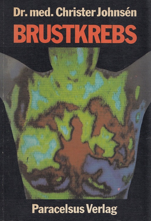 Brustkrebs