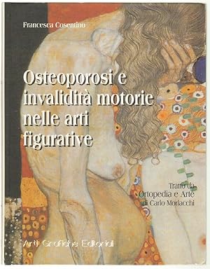 OSTEOPOROSI E INVALIDITA' MOTORIE NELLE ARTI FIGURATIVE di Francesca Cosentino