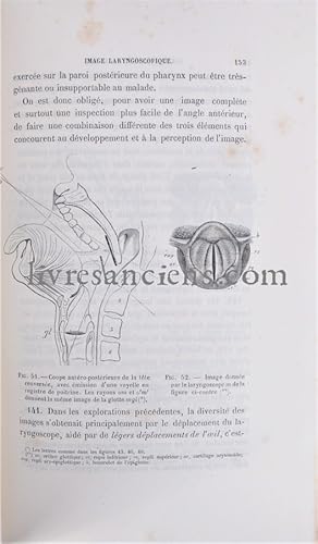 Maladies du Larynx et du Pharynx