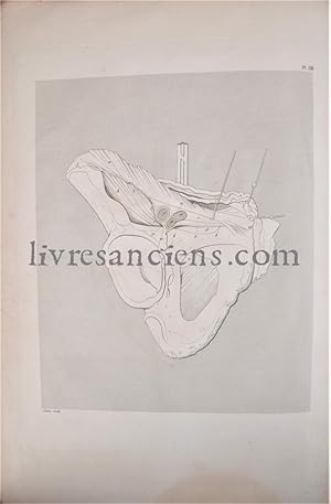 Supplément du Traité pratique des hernies, ou mémoires anatomiques et chirurgiaux sur ces maladies