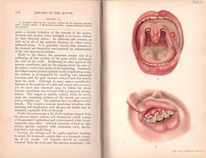 ATLAS AND TEXT-BOOK OF DENTISTRY including the diseases of the mouth.