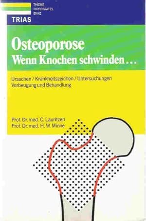 Osteoporose