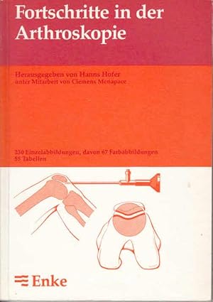 Fortschritte in der Arthroskopie. hrsg. von Hanns Hofer unter Mitarb. von Clemens Menapace / Deut...