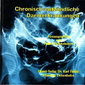 Chronisch entzündliche Darmerkrankungen. Morbus Crohn - Colitis ulcerosa