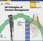 Principles of Fracture Management - Ruedi, Thomas P. Ruedi and William M. Murphy